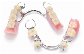 32 Smile Stone Cast Metal Partial Denture