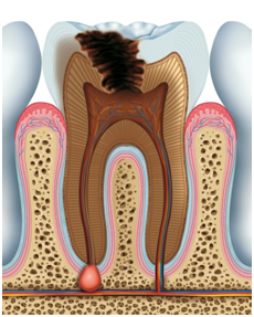 32 Smile Stone Functioning in Mouth