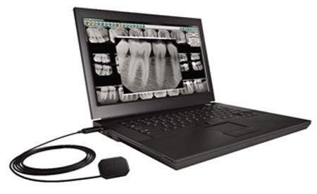 Digital Dental X-rays