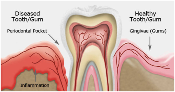 teeth cleaning cost